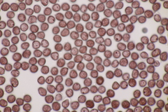 Sphacelotheca hydropiperis