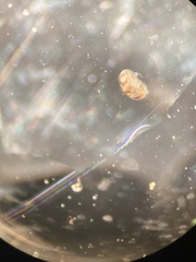 Ostracoda
