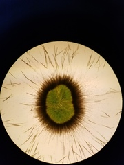 Gloeotrichia echinulata