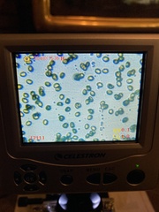 Cortinarius infractus