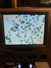 Cortinarius infractus