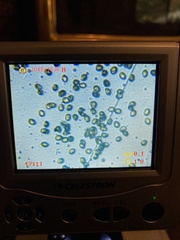 Cortinarius infractus