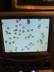 Cortinarius infractus