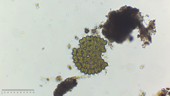 Pseudopediastrum boryanum