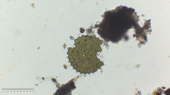 Pseudopediastrum boryanum