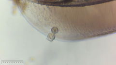 Sessilida