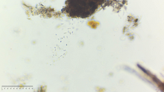 Bacteria