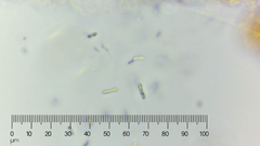 Bacteria