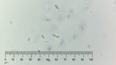 Bacteria