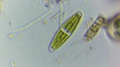 Closterium navicula