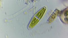 Closterium navicula