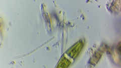 Closterium navicula