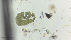 Pseudopediastrum boryanum