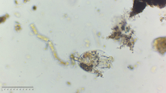 Testudinella