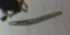 Spirostomum