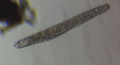 Spirostomum