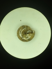 Ventridens suppressus