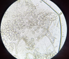 Arcyria cinerea
