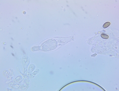 Psathyrella canadensis