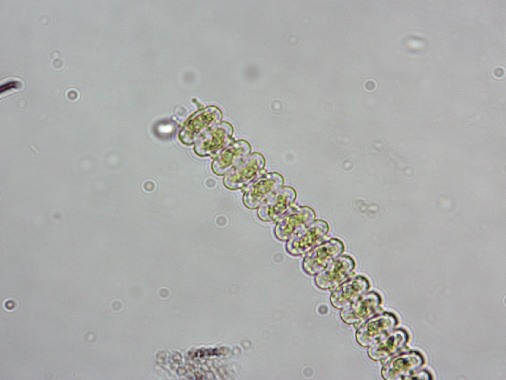 Onychonema