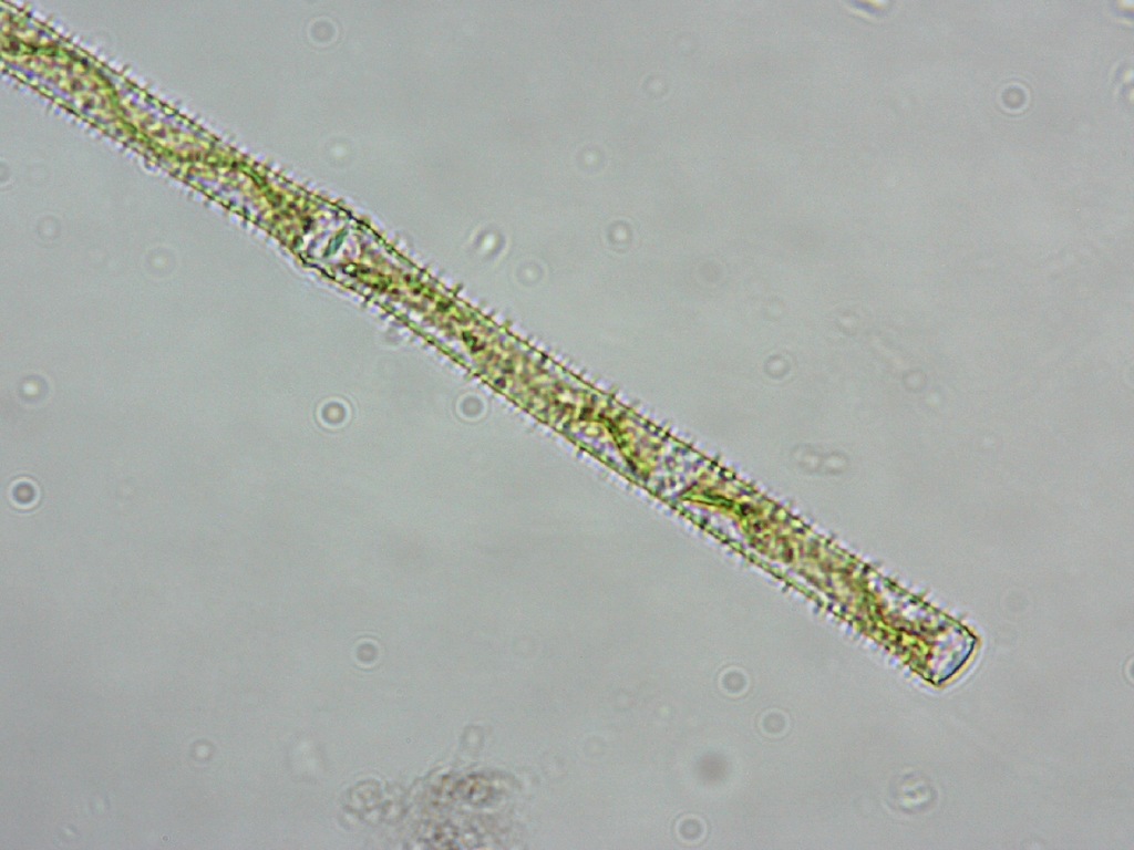 Gonatozygaceae