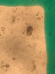 Strongyloides papillosus