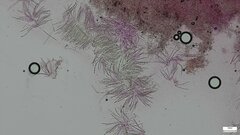 Hypomyces subiculosus