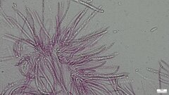 Hypomyces subiculosus