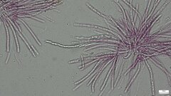 Hypomyces subiculosus