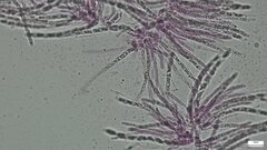 Hypomyces subiculosus