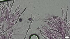 Hypomyces subiculosus