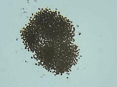 Microcystis