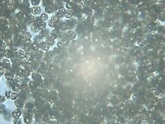 Microcystis