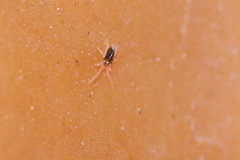 Eupodidae