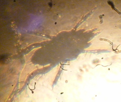 Eupodidae