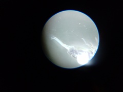 Collembola