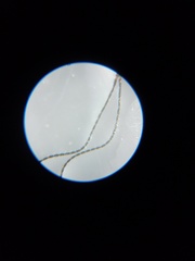 Braconidae