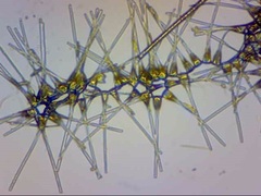 Asterionellopsis glacialis