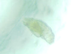 Rotifera