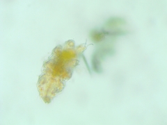Tardigrada