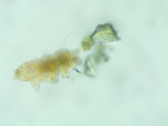 Tardigrada