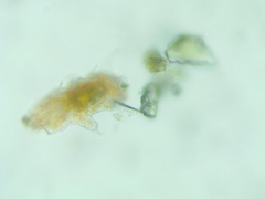 Tardigrada