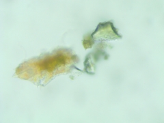 Tardigrada