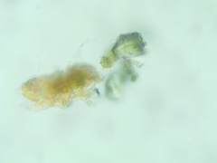 Tardigrada