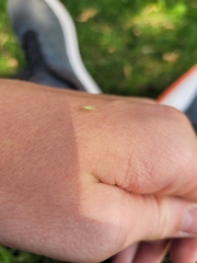 Malacocoris chlorizans