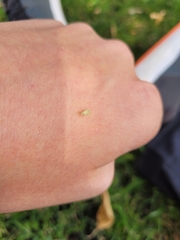 Malacocoris chlorizans