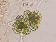 Euastrum ampullaceum