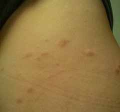 Eutrombicula alfreddugesi