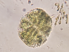 Micrasterias truncata