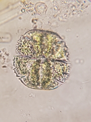 Micrasterias truncata